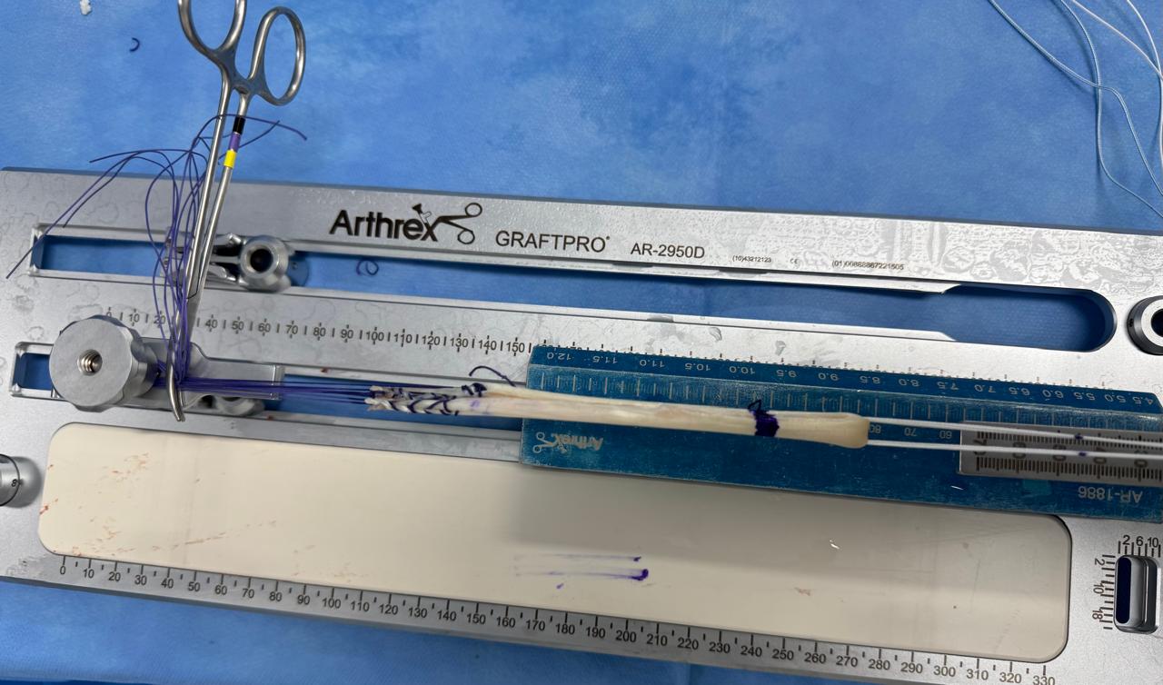 Qual o tempo de recuperação de uma cirurgia de lca